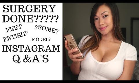 Surgery done??? | Answering Instagram questions ! | Q&As